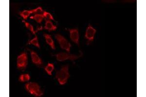 ABIN6274632 staining A549 by IF/ICC. (COX5A antibody  (Internal Region))