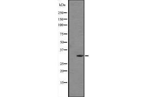 Western blot analysis of FGF5 expression in Human placenta tissue lysate (in RIPA buffer) ;,The lane on the left is treated with the antigen-specific peptide. (FGF5 antibody  (C-Term))