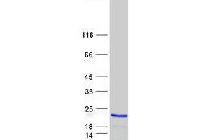 Validation with Western Blot (PFDN2 Protein (Myc-DYKDDDDK Tag))
