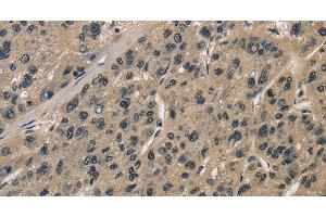 CCAR1 antibody