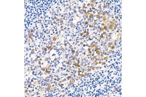Immunohistochemistry of paraffin-embedded human placenta using Phospho--S473 Rabbit mAb (ABIN6135179, ABIN6135970, ABIN6135971 and ABIN7101880) at dilution of 1:100 (40x lens). (AKT1 antibody  (pSer473))