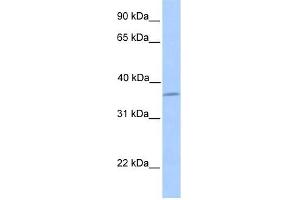 LAYN antibody used at 1 ug/ml to detect target protein. (Layilin antibody  (N-Term))