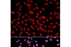 Immunofluorescence analysis of U2OS cells using POLR2J Polyclonal Antibody (POLR2J antibody)