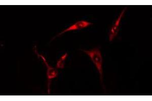 ABIN6274679 staining HT29 cells by IF/ICC. (CIDEB antibody  (Internal Region))