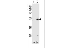 Western blot analysis of FDFT1 (arrow) using rabbit polyclonal FDFT1 Antibody (E11) (ABIN389051 and ABIN2839260). (FDFT1 antibody  (N-Term))