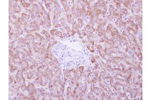 IHC-P Image ANKRD45 antibody detects ANKRD45 protein at cytosol on human normal liver by immunohistochemical analysis. (ANKRD45 antibody)