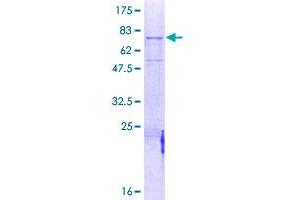 Image no. 1 for Mannan-Binding Lectin Serine Peptidase 1 (MASP1) (AA 1-380) protein (GST tag) (ABIN1310414) (MASP1 Protein (AA 1-380) (GST tag))