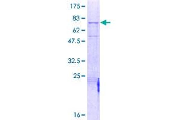 MASP1 Protein (AA 1-380) (GST tag)