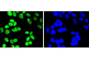 HeLa cells were fixed in paraformaldehyde, permeabilized with 0. (HDAC2 antibody)