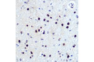 Immunohistochemistry of paraffin-embedded rat brain using HES1 Rabbit mAb (ABIN7267624) at dilution of 1:100 (40x lens). (HES1 antibody)