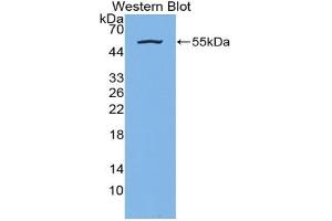 Western blot analysis of the recombinant protein. (Kallikrein 7 antibody  (AA 24-255))