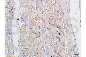 Formalin-fixed and paraffin embedded rat heart labeled with Anti Connexin-37/GJA4 Polyclonal Antibody, Unconjugated  at 1:200 followed by conjugation to the secondary antibody and DAB staining (GJA4 antibody  (AA 151-250))