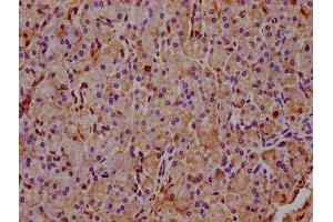 IHC image of ABIN7142862 diluted at 1:400 and staining in paraffin-embedded human pancreatic tissue performed on a Leica BondTM system. (INPP5E antibody  (AA 1-133))