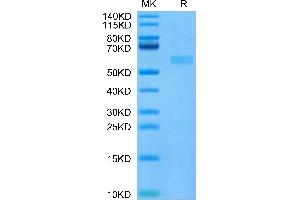 Cynomolgus FGF21 on Tris-Bis PAGE under reduced condition. (FGF21 Protein (AA 29-209) (His tag))