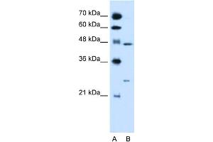 WB Suggested Anti-RXRG Antibody Titration:  0. (Retinoid X Receptor gamma antibody  (N-Term))