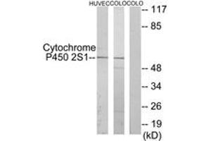 Western blot analysis of extracts from HuvEc/COLO cells, using Cytochrome P450 2S1 Antibody.