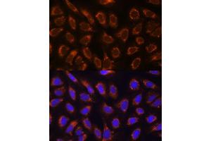 Immunofluorescence analysis of U-2 OS cells using GANAB antibody  at dilution of 1:100. (GANAB antibody  (AA 1-260))