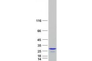 Validation with Western Blot