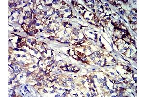 Immunohistochemistry (IHC) image for anti-Integrin beta 3 (ITGB3) (AA 27-179) antibody (ABIN7193294)