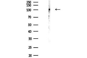 anti-RNA Binding Motif Protein 25 (RBM25) antibody