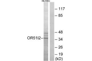 Western blot analysis of extracts from HUVEC cells, using OR51I2 antibody.