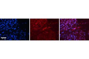 Rabbit Anti-EWSR1 Antibody   Formalin Fixed Paraffin Embedded Tissue: Human Testis Tissue Observed Staining: Cytoplasm, nucleus and plasma membrane in spermatogonia, spermatocytes and smooth muscle cells Primary Antibody Concentration: 1:100 Other Working Concentrations: 1:600 Secondary Antibody: Donkey anti-Rabbit-Cy3 Secondary Antibody Concentration: 1:200 Magnification: 20X Exposure Time: 0. (EWSR1 antibody  (N-Term))