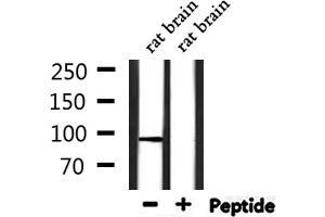 Western blot analysis of extracts from rat brain, using TRPV4 Antibody. (TRPV4 antibody  (C-Term))
