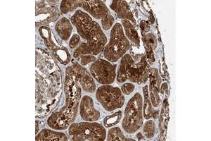 Immunohistochemical staining of human kidney with SNX2 polyclonal antibody  shows strong cytoplasmic and extracellular positivity in tubular cells at 1:500-1:1000 dilution. (Sorting Nexin 2 antibody)