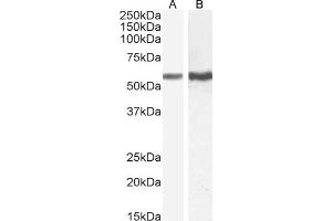 TGFBR1 Antikörper  (AA 50-63)