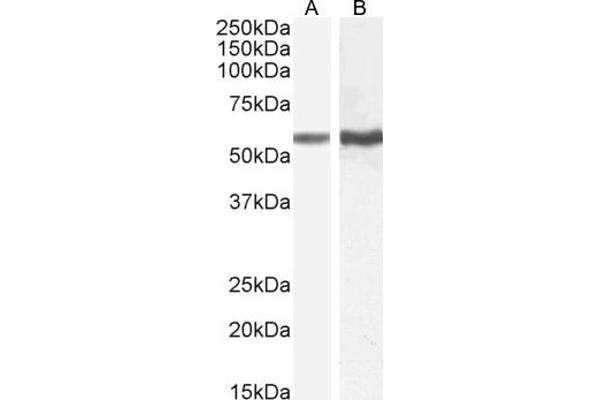 TGFBR1 anticorps  (AA 50-63)