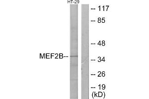 Western blot analysis of extracts from HT-29 cells, using MEF2B antibody. (MEF2B antibody  (Internal Region))