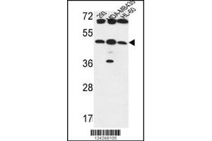 Western blot analysis in 293,MDA-MB435,HL-60 cell line lysates (35ug/lane). (B3GNT5 antibody  (AA 118-145))