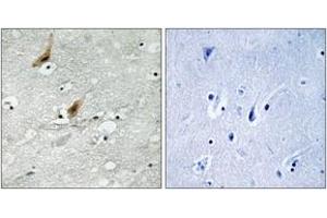 Immunohistochemistry analysis of paraffin-embedded human brain, using MSK2 (Phospho-Thr568) Antibody. (MSK2 antibody  (pThr568))