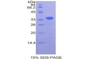 SDS-PAGE analysis of Rat PRDM1 Protein. (PRDM1 Protein)