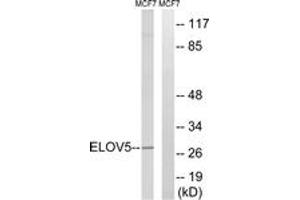 Western blot analysis of extracts from MCF-7 cells, using ELOVL5 Antibody. (ELOVL5 antibody  (AA 250-299))