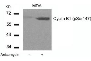 Western blot analysis of extracts from MDA cells untreated or treated with Anisomycin using Cyclin B1(phospho-Ser147) Antibody. (Cyclin B1 antibody  (pSer147))