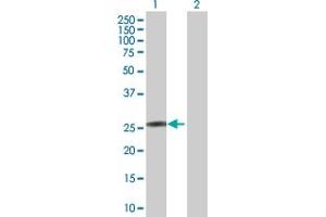 Western Blot analysis of KCNIP4 expression in transfected 293T cell line by KCNIP4 MaxPab polyclonal antibody. (KCNIP4 antibody  (AA 1-250))
