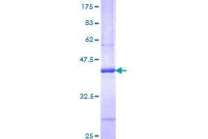 Image no. 1 for Interleukin 13 (IL13) (AA 35-146) protein (GST tag) (ABIN1307687) (IL-13 Protein (AA 35-146) (GST tag))