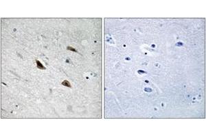 Immunohistochemistry analysis of paraffin-embedded human brain, using Catenin-beta (Phospho-Tyr489) Antibody. (beta Catenin antibody  (pTyr489))