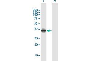 Western Blot analysis of SGCD expression in transfected 293T cell line by SGCD MaxPab polyclonal antibody. (SGCD antibody  (AA 1-290))