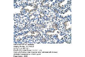 Rabbit Anti-EIF2S1 Antibody  Paraffin Embedded Tissue: Human Lung Cellular Data: Alveolar cells Antibody Concentration: 4.