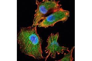 Immunofluorescence analysis of U251 cells using IL34 mouse mAb (green). (IL-34 antibody)