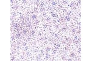 Immunohistochemistry (IHC) image for anti-Plexin Domain Containing 1 (PLXDC1) (C-Term) antibody (ABIN1030730) (PLXDC1 antibody  (C-Term))