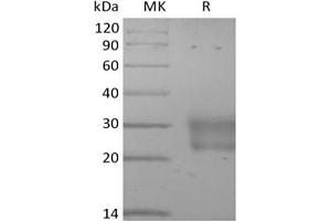 FZD8 Protein (His tag)