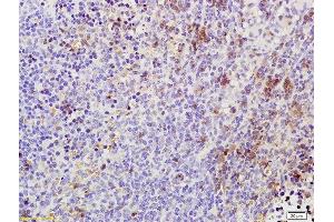 Formalin-fixed and paraffin embedded rat spleen labeled with Rabbit Anti Phospho-TAK1(Thr184/187) Polyclonal Antibody, Unconjugated (ABIN746348) at 1:200 followed by conjugation to the secondary antibody and DAB staining (TR4 antibody  (pThr184, pThr187))