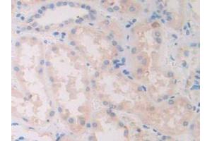 IHC-P analysis of Human Kidney Tissue, with DAB staining. (SLIT1 antibody  (AA 647-835))