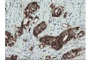 Image no. 4 for anti-Cytidine Monophosphate (UMP-CMP) Kinase 1, Cytosolic (CMPK1) antibody (ABIN1497544) (Cytidine Monophosphate (UMP-CMP) Kinase 1, Cytosolic (CMPK1) antibody)