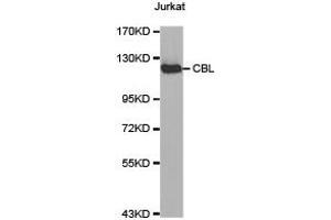 Western Blotting (WB) image for anti-Cas-Br-M (Murine) Ecotropic Retroviral Transforming Sequence (CBL) antibody (ABIN1871485) (CBL antibody)