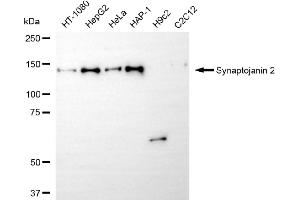 anti-Synaptojanin 2 (SYNJ2) antibody
