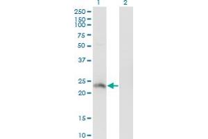 HSFY2 antibody  (AA 1-100)